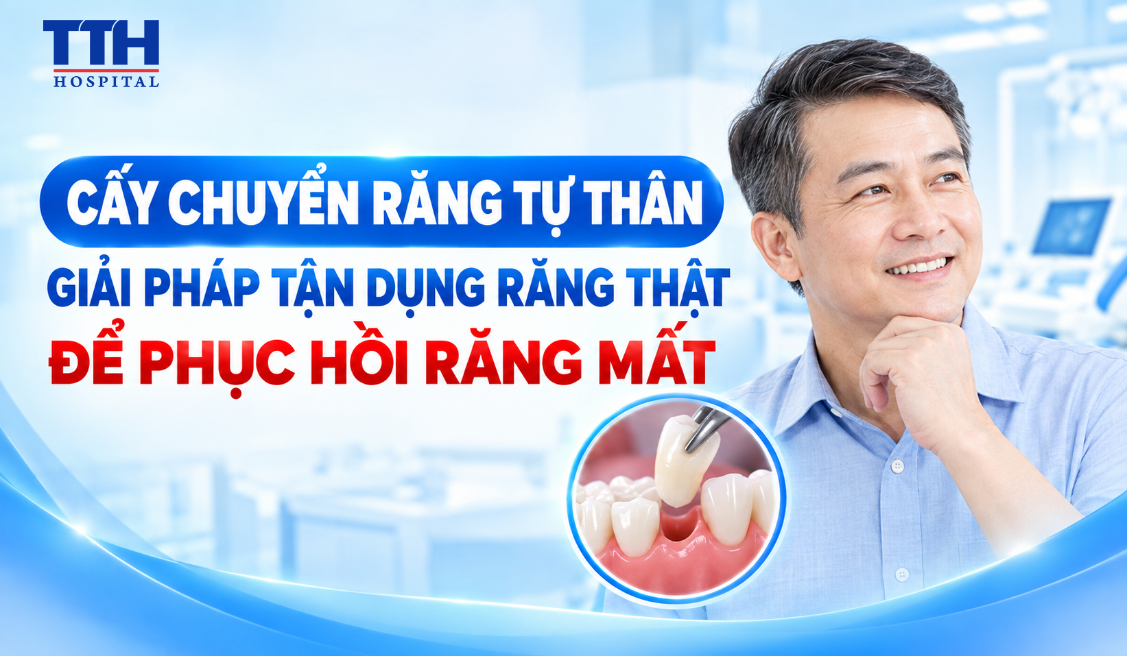 CẤY CHUYỂN RĂNG TỰ THÂN: GIẢI PHÁP TẬN DỤNG RĂNG THẬT ĐỂ PHỤC HỒI RĂNG MẤT