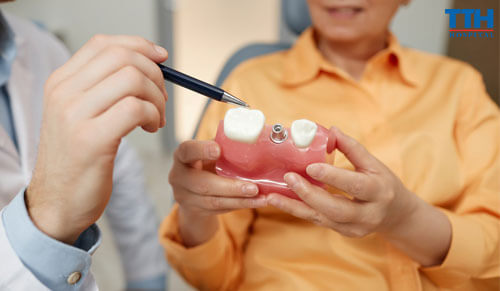 Chăm Sóc Răng Implant Như Thế Nào Để Đạt Hiệu Quả Tốt Nhất?