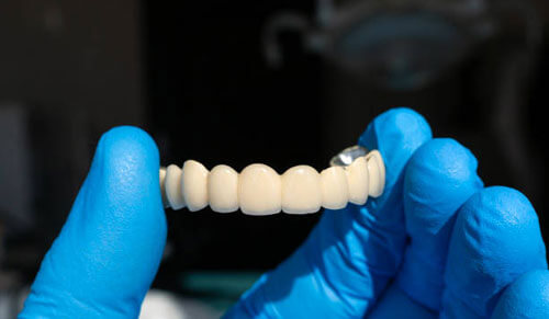 Chăm Sóc Răng Sứ Zirconia: Bí Quyết Duy Trì Độ Bền và Đẹp