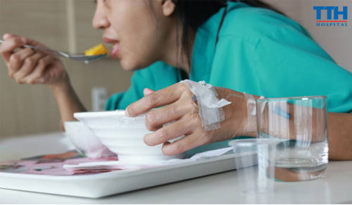 Chế Độ Dinh Dưỡng Sau Khi Trồng Răng Implant