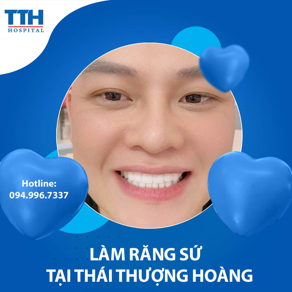 Có nên làm răng sứ