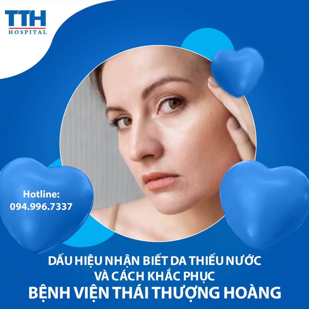 Dấu hiệu nhận biết da thiếu nước và cách khắc phục