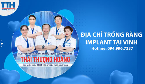 Địa chỉ Trồng Răng Implant tại Vinh, Nghệ An