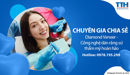 Chuyên gia chia sẻ: Diamond Veneer - Công nghệ dán răng sứ thẩm mỹ hoàn hảo