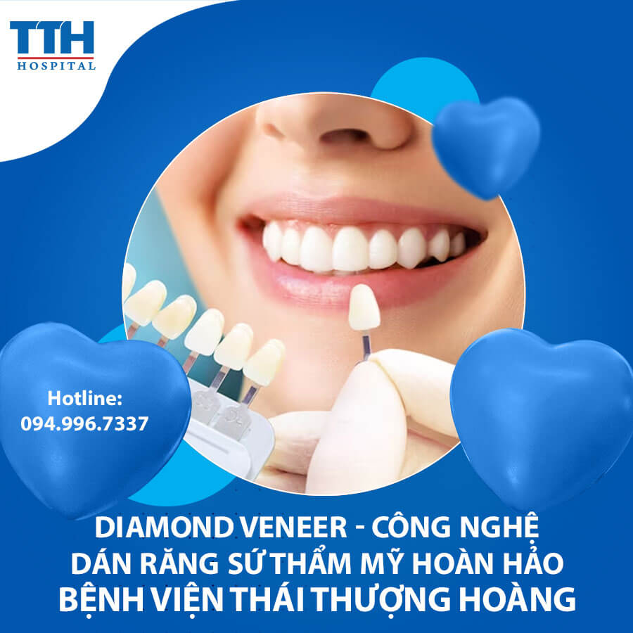 Chuyên gia chia sẻ: Diamond Veneer - Công nghệ dán răng sứ thẩm mỹ hoàn hảo