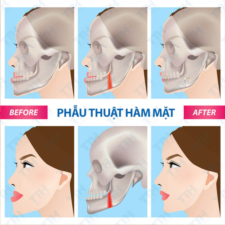 Dịch Vụ Phẫu Thuật Hàm Mặt Tại Bệnh Viện Thái Thượng Hoàng