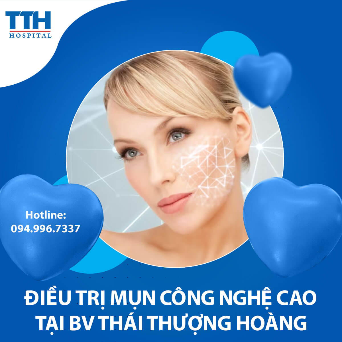 Điều trị mụn - Những công nghệ mới nhất