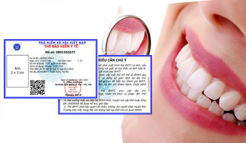 Điều Trị Tủy Răng Có Được Bảo Hiểm Y Tế Không?
