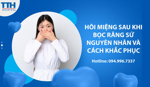 Hôi Miệng sau Khi Bọc Răng Sứ: Nguyên Nhân và Cách Khắc Phục