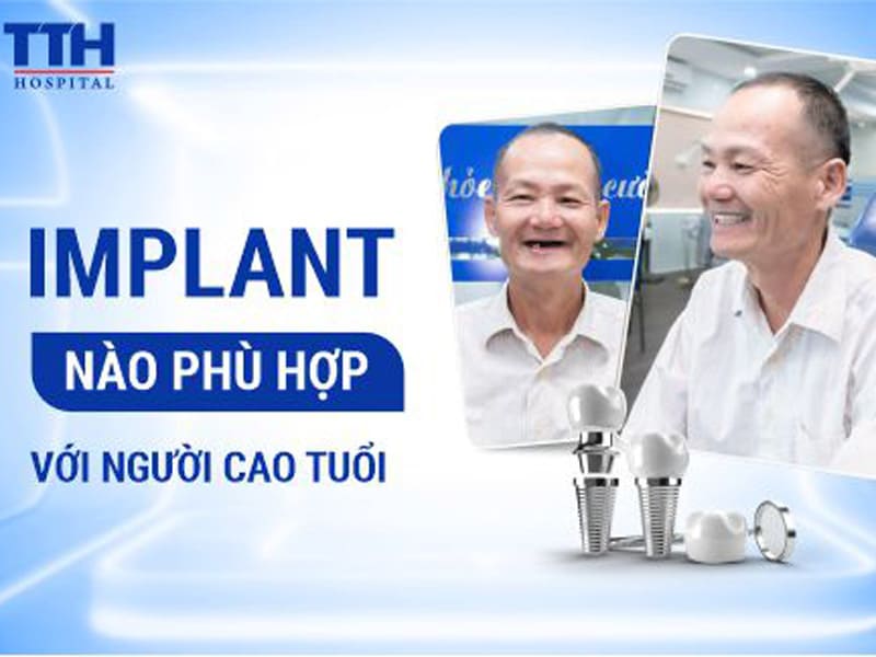 Implant nào phù hợp với người cao tuổi hoặc xương hàm yếu?
