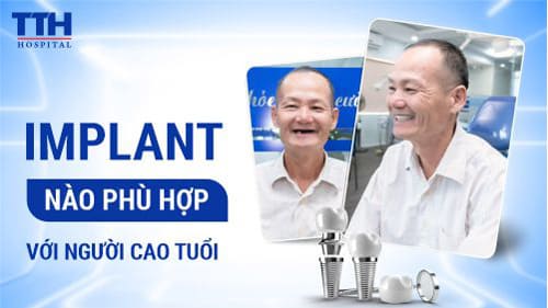 Implant nào phù hợp với người cao tuổi hoặc xương hàm yếu?