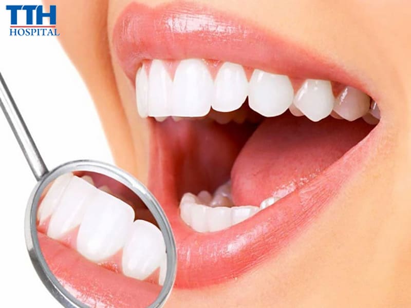 Khi nào nên và không nên bọc răng sứ?