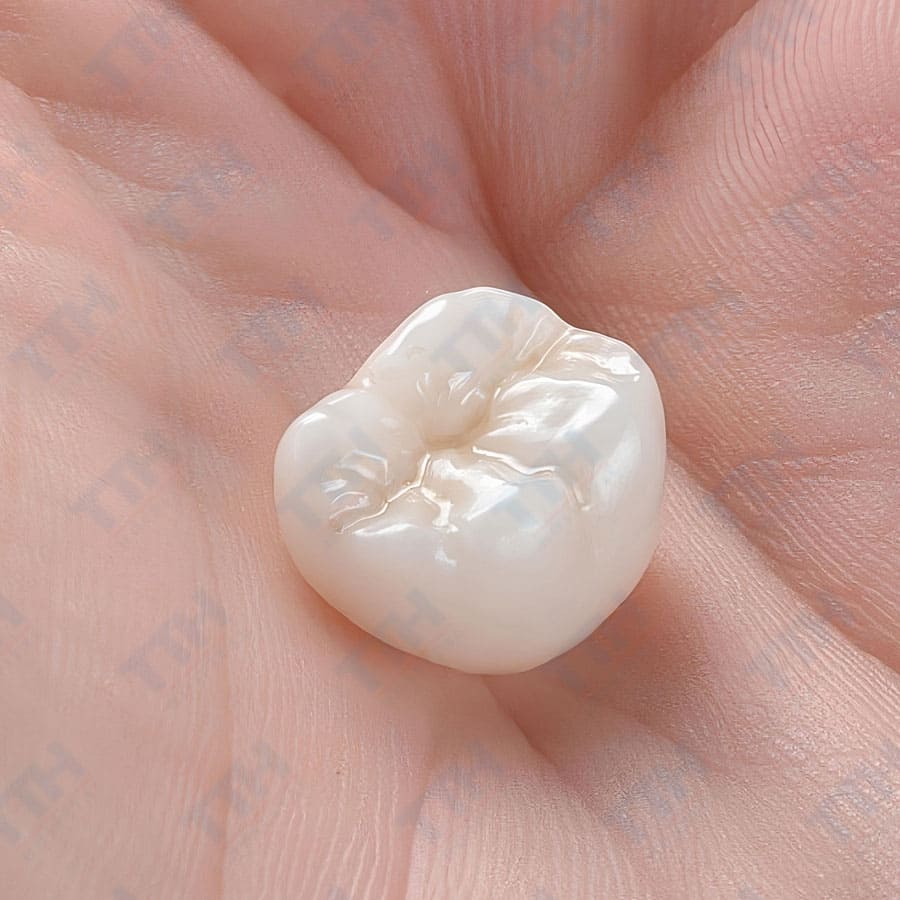 Kinh Nghiệm Bọc Răng Sứ Thẩm Mỹ Từ Chuyên Gia Chia Sẻ