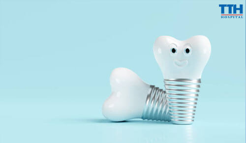 Lợi Ích Của Trồng Răng Implant So Với Các Phương Pháp Truyền Thống