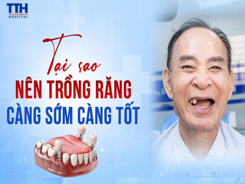 Mất răng - Tại sao nên trồng răng càng sớm càng tốt? 