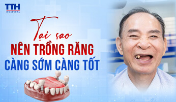Mất răng - Tại sao nên trồng răng càng sớm càng tốt? 