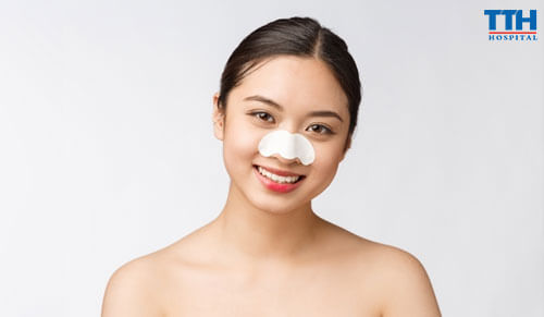Nâng mũi bằng sụn Surgiform được bao lâu?