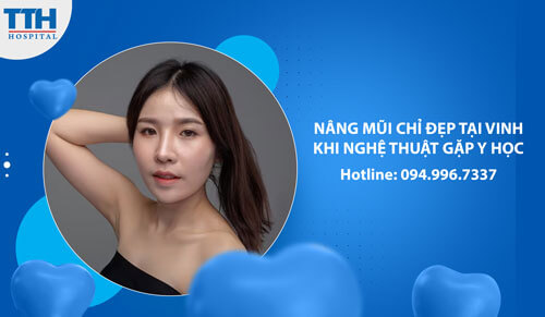 Nâng Mũi Chỉ Đẹp Tại Vinh: Khi Nghệ Thuật Gặp Y Học