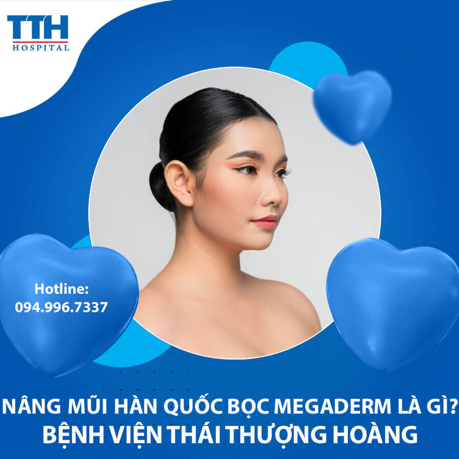 Nâng mũi Hàn Quốc bọc Megaderm là gì? Có tốt không?