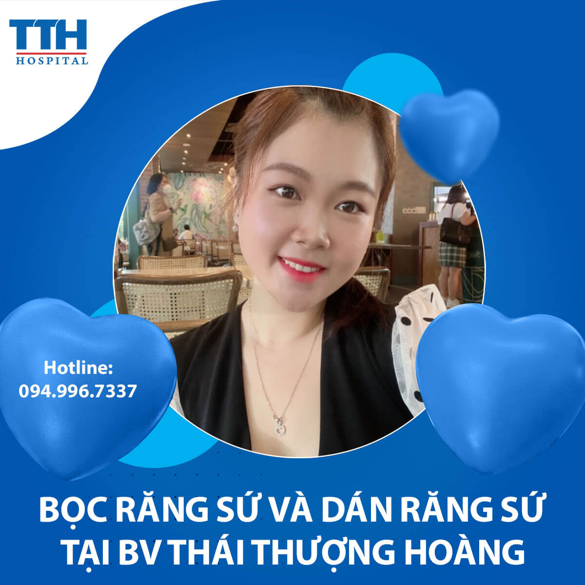 Nên Dán Răng Sứ hay Bọc Răng Sứ?