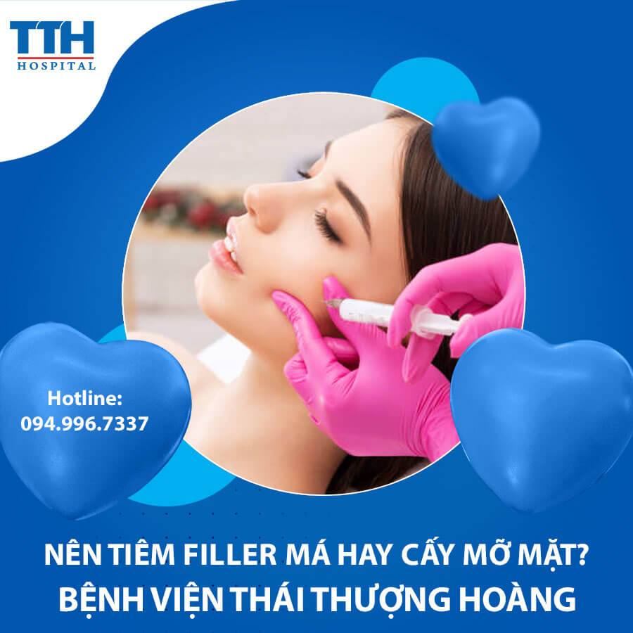 Nên tiêm filler má hay cấy mỡ mặt?