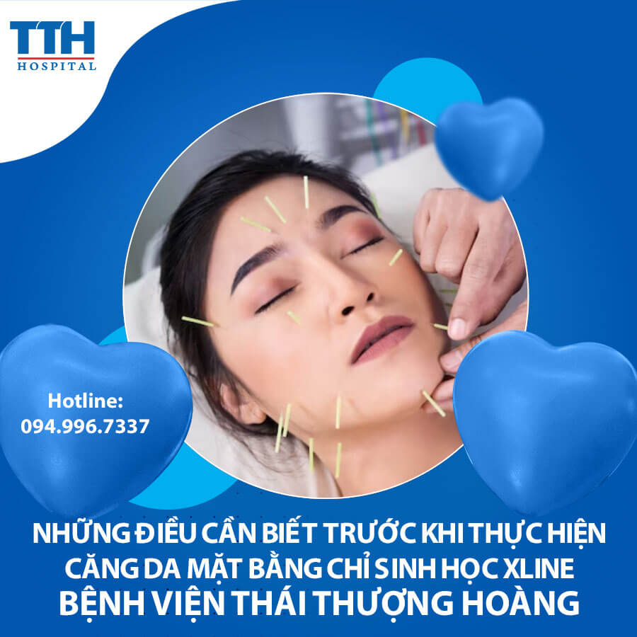 Những điều cần biết trước khi thực hiện căng da mặt bằng chỉ sinh học Xline
