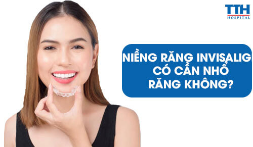 Niềng Răng Invisalign Có Cần Nhổ Răng Không?