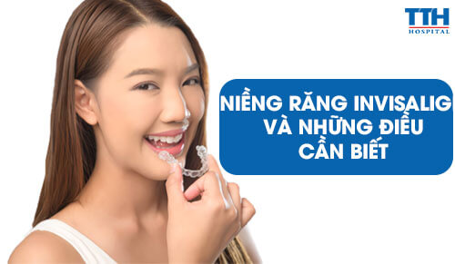 Niềng Răng Invisalign Và Những Điều Cần Biết
