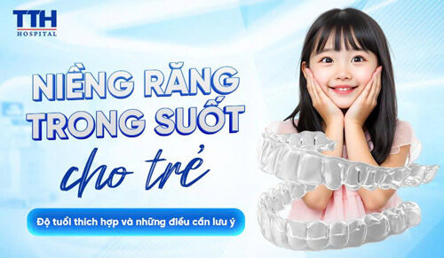 Niềng răng trong suốt cho trẻ em: Độ tuổi thích hợp và những điều cần lưu ý