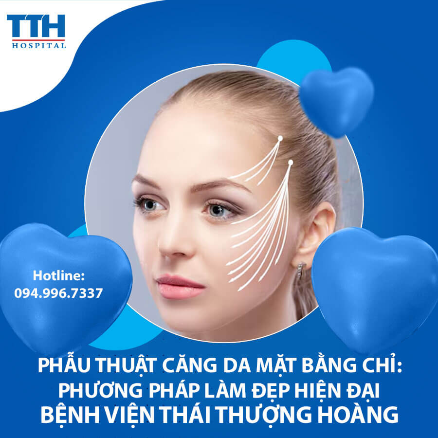 Phẫu thuật căng da mặt bằng chỉ: Phương pháp làm đẹp hiện đại