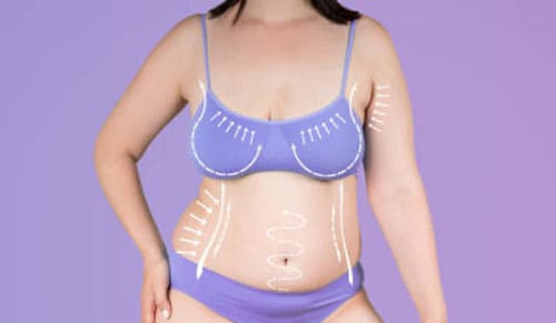 Phụ nữ hút mỡ bụng và nâng ngực cùng lúc được không?