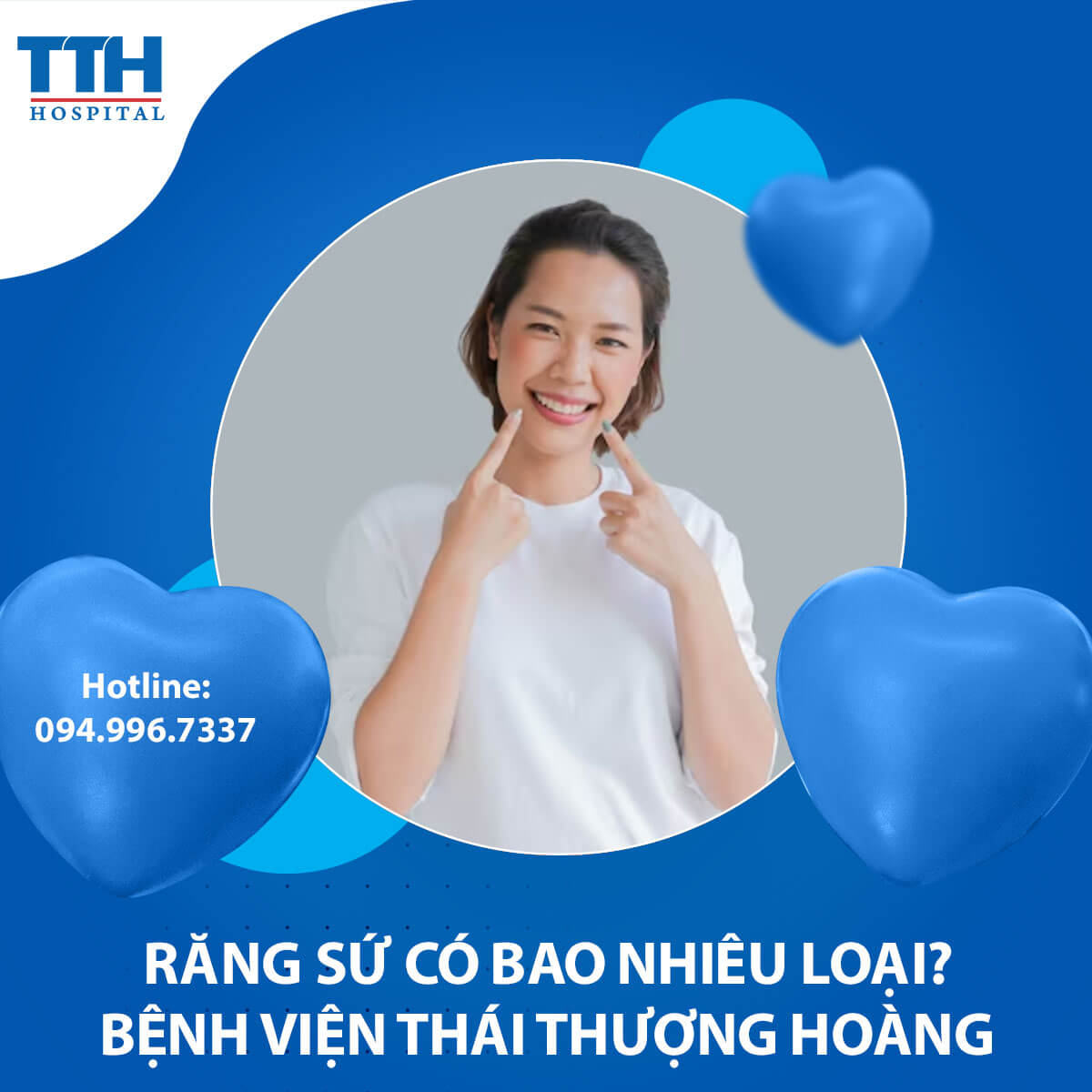 Răng sứ có bao nhiêu loại?