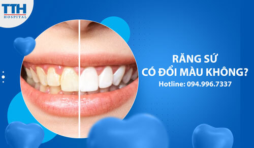 Răng sứ có đổi màu không?