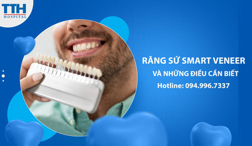 Răng Sứ Diamond Veneer và những điều cần biết