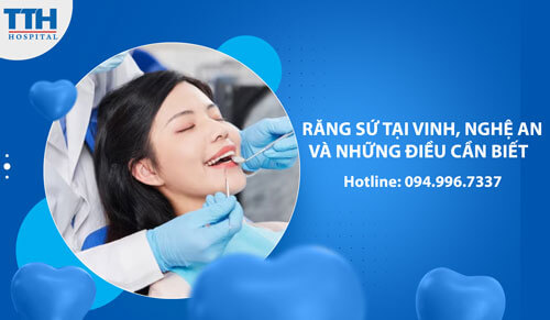 Răng Sứ tại Vinh, Nghệ An Và Những Điều Cần Biết  
