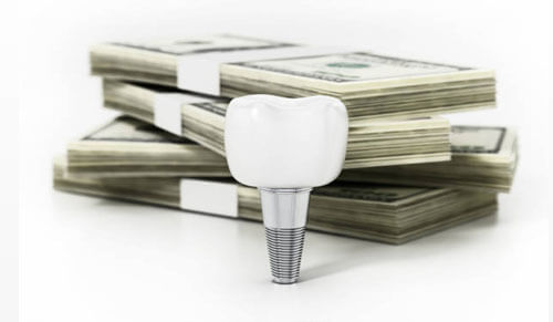 Răng Sứ Zirconia Giá Bao Nhiêu?