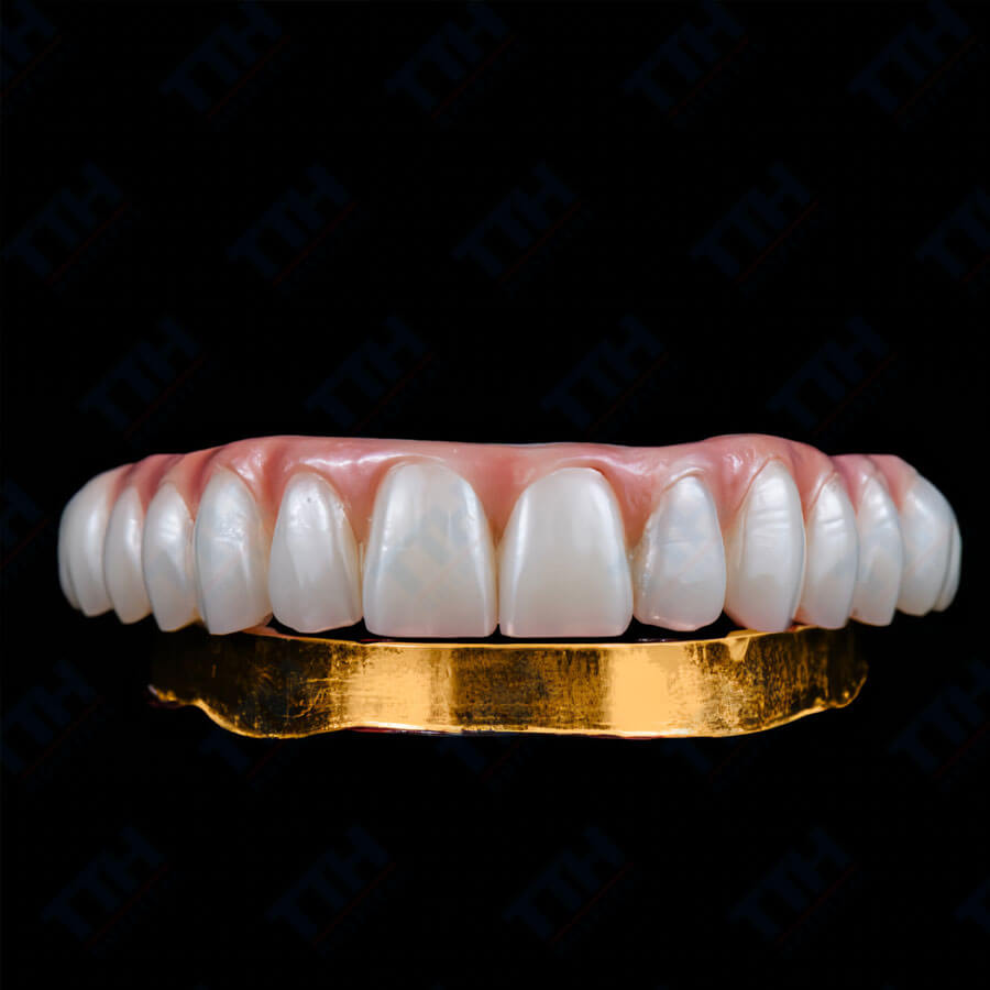 Răng Sứ Zirconia + Noritake: Lựa Chọn Hoàn Hảo Cho Nụ Cười Rạng Rỡ