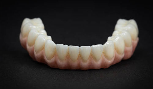 Răng Sứ Zirconia + Noritake: Lựa Chọn Hoàn Hảo Cho Nụ Cười Rạng Rỡ