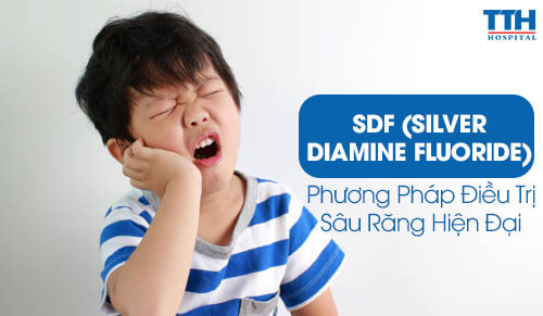 SDF (Silver Diamine Fluoride): Phương Pháp Điều Trị Sâu Răng Hiện Đại