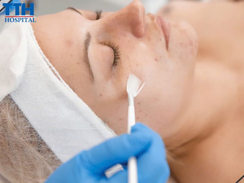 Hướng dẫn chăm sóc da tại nhà sau điều trị bớt sắc tố, xóa xăm