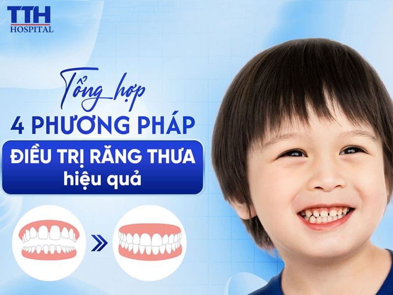 Tổng hợp 4 phương pháp điều trị răng thưa hiệu quả