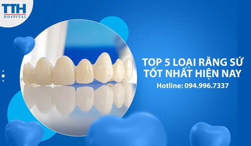 Top 5 loại răng sứ tốt nhất hiện nay