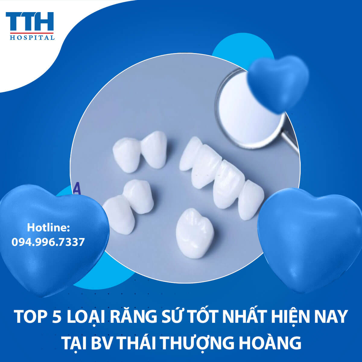Top 5 loại răng sứ tốt nhất hiện nay