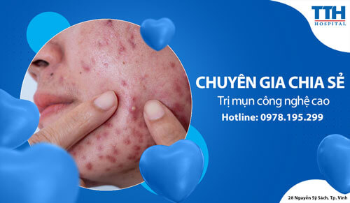 Trị mụn công nghệ cao