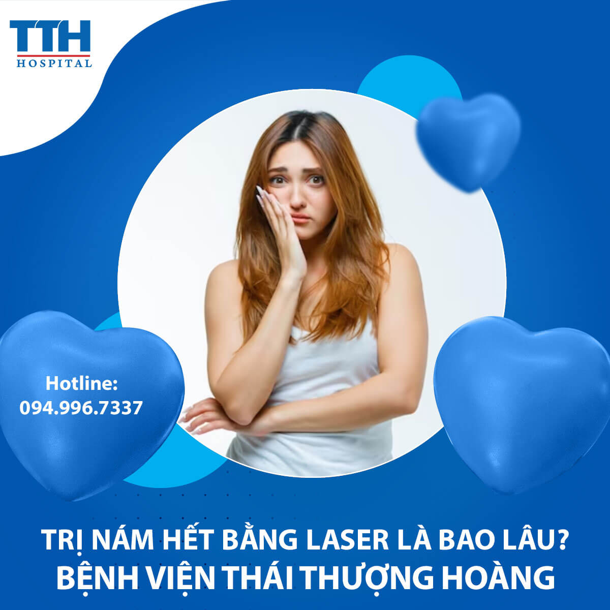 Trị Nám Bằng Laser: Thời Gian Hết Nám Là Bao Lâu?