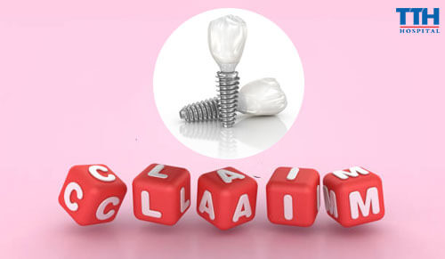 Trồng Răng Implant Ảnh Hưởng Đến Khả Năng Phát Âm?