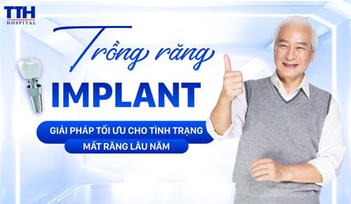 Trồng răng Implant - Giải pháp tối ưu cho tình trạng mất răng lâu năm