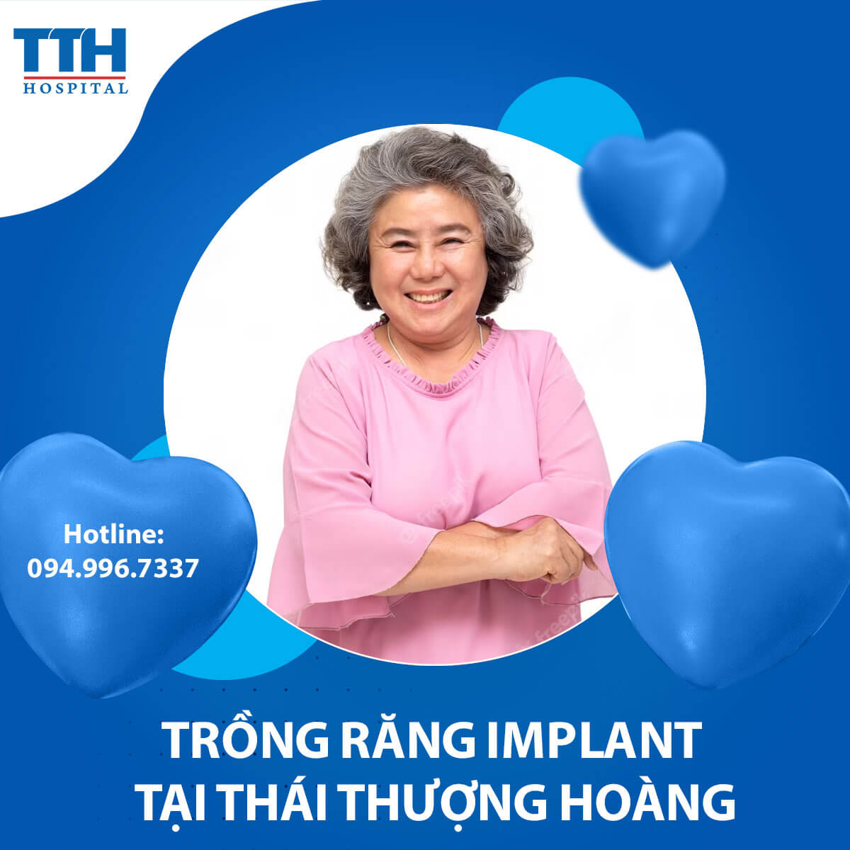 Trồng Răng Implant và Những Điều cần biết trước khi làm