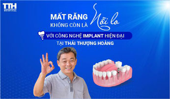 Trồng Răng Implant Thời Nay – Không Còn Là Nỗi Lo!