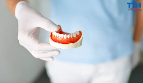 Trồng Răng Implant Và Sức Khỏe Xương Hàm: Những Điều Bạn Nên Biết